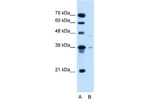 WB Suggested Anti-SLC17A3 Antibody Titration:  0. (SLC17A3 anticorps  (Middle Region))