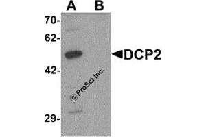 Western Blotting (WB) image for anti-DCP2 Decapping Enzyme Homolog (DCP2) (C-Term) antibody (ABIN1077379) (DCP2 anticorps  (C-Term))