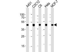 All lanes : Anti-ACTB Antibody at 1:1000 dilution Lane 1: A431 whole cell lysate Lane 2: C2C12 whole cell lysate Lane 3: C6 whole cell lysate Lane 4: Hela whole cell lysate Lane 5: MCF-7 whole cell lysate Lysates/proteins at 20 μg per lane.