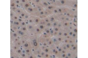 Used in DAB staining on fromalin fixed paraffin- embedded Kidney tissue (DP1 anticorps  (AA 6-410))