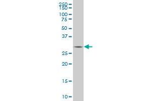 TGIF2 monoclonal antibody (M06), clone 6A8 Western Blot analysis of TGIF2 expression in IMR-32 .