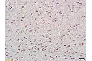 Formalin-fixed and paraffin embedded rat brain labeled with Anti-SEMA4A Polyclonal Antibody, Unconjugated (ABIN873193) at 1:200 followed by conjugation to the secondary antibody and DAB staining.