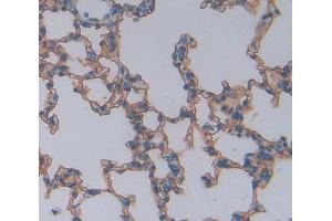Used in DAB staining on fromalin fixed paraffin- embedded lung tissue (CSK anticorps  (AA 243-438))