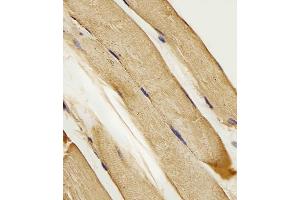 (ABIN657159 and ABIN2846293) staining SLC16A10 in Human skeletal muscle tissue sections by Immunohistochemistry (IHC-P - paraformaldehyde-fixed, paraffin-embedded sections).