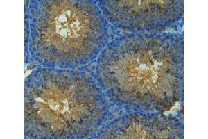 IHC-P analysis of tissue, with DAB staining. (NOS2 anticorps  (AA 43-213))