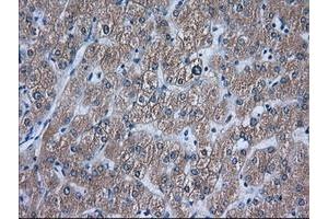 Image no. 5 for anti-Acetyl-CoA Acetyltransferase 2 (ACAT2) antibody (ABIN1496404)