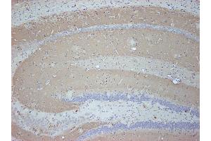 Immunostaining of paraffin embedded sections from mouse brain (dilution 1 : 500). (SV2B anticorps  (AA 2-17))