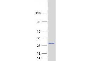 Validation with Western Blot