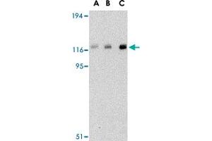 Western blot analysis of CBL in Daudi cell lysate with CBL polyclonal antibody  at (A) 0. (CBL anticorps  (C-Term))