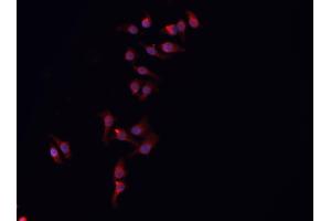 ABIN6266833 staining HeLa  cells by IF/ICC. (ARMCX3 anticorps  (N-Term))
