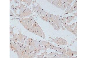 Immunohistochemistry of paraffin-embedded Rat heart using Phospho-BRCA1(S1423) Polyclonal Antibody at dilution of 1:100 (40x lens).