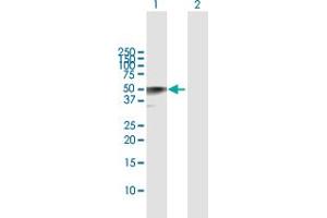Western Blot analysis of CALR3 expression in transfected 293T cell line by CALR3 MaxPab polyclonal antibody. (Calreticulin 3 anticorps  (AA 1-384))