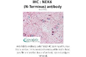 Image no. 1 for anti-NIMA (Never in Mitosis Gene A)-Related Kinase 6 (NEK6) (N-Term) antibody (ABIN1737252) (NEK6 anticorps  (N-Term))