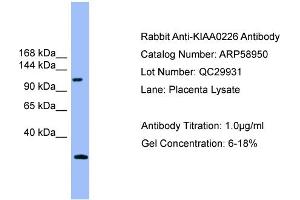 WB Suggested Anti-KIAA0226  Antibody Titration: 0. (Rubicon anticorps  (Middle Region))