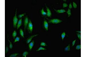 Immunofluorescent analysis of Hela cells using ABIN7160924 at dilution of 1:100 and Alexa Fluor 488-congugated AffiniPure Goat Anti-Rabbit IgG(H+L)