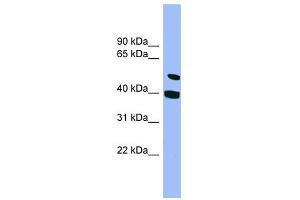 SMU1 antibody used at 1 ug/ml to detect target protein. (SMU1 anticorps)