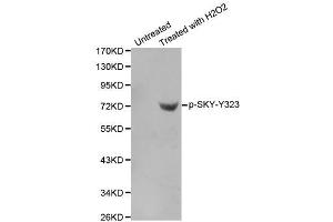 Western blot analysis of extracts from Jurkat cells using phospho-SYK-Y323 antibody (ABIN2987845). (SYK anticorps  (pTyr323))