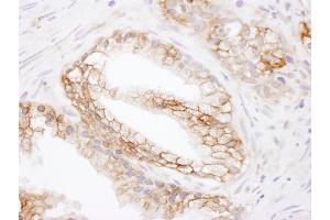 Immunohistochemistry (IHC) image for anti-Solute Carrier Family 16, Member 1 (Monocarboxylic Acid Transporter 1) (SLC16A1) (AA 450-500) antibody (ABIN7455025)