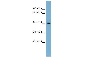 WB Suggested Anti-VPS37C Antibody Titration: 0. (VPS37C anticorps  (N-Term))