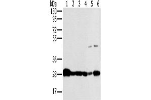 Western Blotting (WB) image for anti-NADH Dehydrogenase (Ubiquinone) Fe-S Protein 3, 30kDa (NADH-Coenzyme Q Reductase) (NDUFS3) antibody (ABIN2423863) (NDUFS3 anticorps)