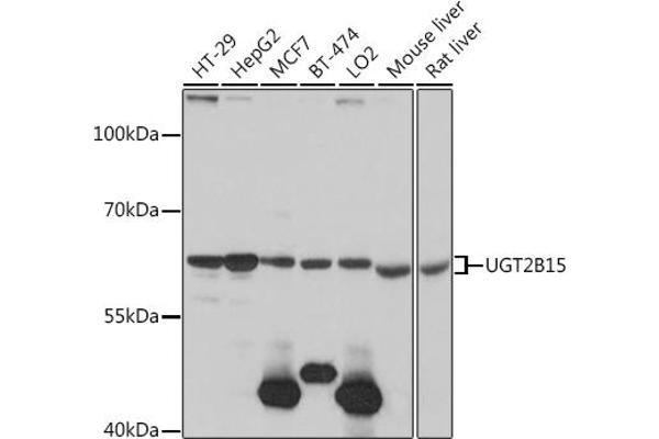 UGT2B15 抗体  (AA 60-190)