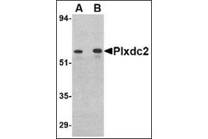 Western blot analysis of Plxdc2 in human colon tissue lysate with this product at (A) 0. (PLXDC2 anticorps  (C-Term))