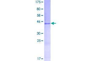 Image no. 1 for Gremlin 2 (GREM2) (AA 1-168) protein (GST tag) (ABIN1355714)