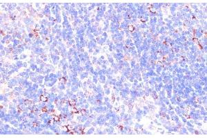 Immunohistochemistry of paraffin-embedded Mouse spleen using ZYX Polyclonal Antibody at dilution of 1:100 (40x lens). (ZYX anticorps)