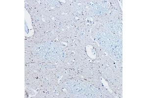 Immunohistochemistry of paraffin-embedded human brain using Phospho-Tau-S396 Rabbit mAb (ABIN7268523) at dilution of 1:100 (40x lens).