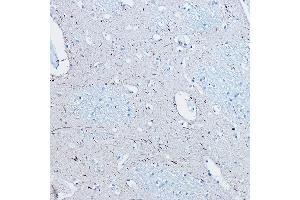 Immunohistochemistry of paraffin-embedded human brain using Phospho-Tau-S396 Rabbit mAb (ABIN7268523) at dilution of 1:100 (40x lens). (MAPT anticorps  (pSer396))
