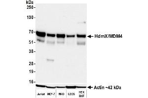 Western Blotting (WB) image for anti-Mdm4-binding Protein (MDM4) (AA 125-175) antibody (ABIN7453327) (Recombinant MDM4-binding Protein anticorps  (AA 125-175))