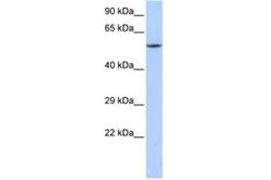 Image no. 1 for anti-Calcium Channel, Voltage-Dependent, beta 1 Subunit (CACNB1) (C-Term) antibody (ABIN6742715)