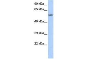 Image no. 1 for anti-Calcium Channel, Voltage-Dependent, beta 1 Subunit (CACNB1) (C-Term) antibody (ABIN6742715) (CACNB1 anticorps  (C-Term))