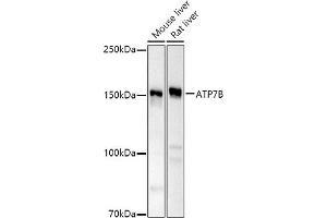 Western blot analysis of extracts of various cell lines, using B antibody (ABIN6127395, ABIN6137355, ABIN6137356 and ABIN6221328) at 1:500 dilution. (ATP7B anticorps  (AA 1055-1354))