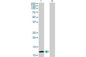 Western Blot analysis of KISS1 expression in transfected 293T cell line by KISS1 MaxPab polyclonal antibody. (KISS1 anticorps  (AA 1-138))