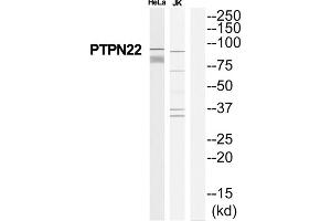Western Blotting (WB) image for anti-Tyrosine-Protein Phosphatase Non-Receptor Type 22 (PTPN22) (Internal Region) antibody (ABIN1852320) (PTPN22 anticorps  (Internal Region))