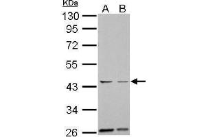 WB Image Aurora A antibody [C3], C-term detects AURKA protein by Western blot analysis.