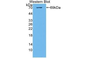 Western blot analysis of the recombinant protein. (KIAA1524 anticorps  (AA 230-560))