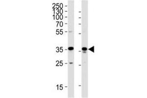 Western blot analysis of lysate from HeLa, HUVEC cell line (left to right) using GAPDH antibody; Ab was diluted at 1:1000 for each lane.