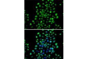 Immunofluorescence analysis of A-549 cells using NTMT1 antibody (ABIN6133076, ABIN6144899, ABIN6144900 and ABIN6222903). (METTL11A anticorps  (AA 1-223))