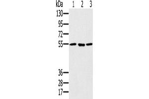 Western Blotting (WB) image for anti-Proteasome (Prosome, Macropain) 26S Subunit, ATPase, 1 (PSMC1) antibody (ABIN2424001) (PSMC1 anticorps)