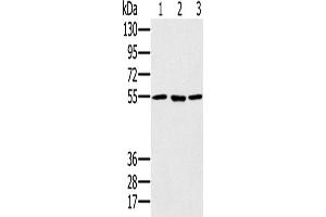 Western Blotting (WB) image for anti-Proteasome (Prosome, Macropain) 26S Subunit, ATPase, 1 (PSMC1) antibody (ABIN2424001)