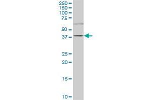 TRIM6-TRIM34 polyclonal antibody (A01), Lot # 060728QCS1.