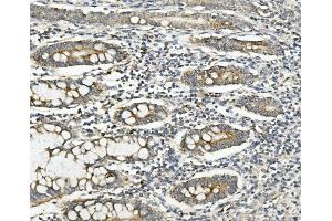 IHC analysis of Methylmalonyl Coenzyme A using anti-Methylmalonyl Coenzyme A antibody (ABIN7603112). (MUT anticorps  (N-Term))