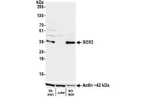 Western Blotting (WB) image for anti-SRY (Sex Determining Region Y)-Box 2 (SOX2) antibody (ABIN7449421)