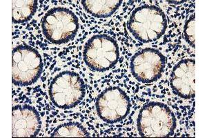 Immunohistochemical staining of paraffin-embedded Human colon tissue using anti-AK3 mouse monoclonal antibody. (Adenylate Kinase 3 anticorps)