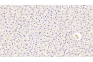 Detection of C5a in Rat Liver Tissue using Polyclonal Antibody to Complement Component 5a (C5a) (C5A anticorps  (AA 12-64))
