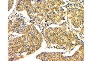 IHC analysis of GM130 using anti-GM130 antibody (ABIN6719432). (Golgin A2 (GOLGA2) (AA 796-913) anticorps)