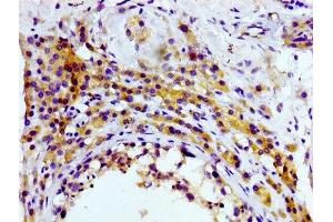 IHC image of ABIN7127284 diluted at 1:100 and staining in paraffin-embedded human testis tissue performed on a Leica BondTM system. (Recombinant CD81 anticorps)