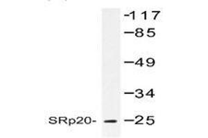 Image no. 1 for anti-serine/arginine-Rich Splicing Factor 3 (SRSF3) antibody (ABIN317610) (SRSF3 anticorps)